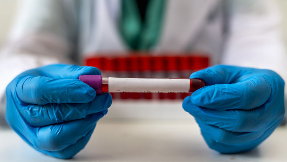 Lynch Syndrome: Understanding the Inherited Cancer Risk