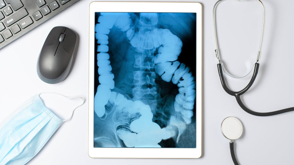 Sitz Marker Test: How Doctors Measure Your Gut’s “Traffic Speed”